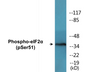 Western blot analysis of extracts from K562 cells treated with IFN-alpha 1000U/ml 18h, using eIF2 alpha (Phospho-Ser51) Antibody.