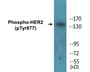 Western blot analysis of extracts from HepG2 cells and HeLa cells, using HER2 (Phospho-Tyr877) Antibody.