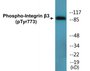 Western blot analysis of extracts from HL-60 cells treated with H2O2, using Integrin beta3 (Phospho-Tyr773) Antibody.