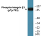 Western blot analysis of extracts from HeLa cells, HepG2 cells and HuvEc cells, using Integrin beta3 (Phospho-Tyr785) Antibody.
