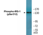 Western blot analysis of extracts from HepG2 cells, using IRS-1 (Phospho-Ser312) Antibody.