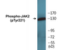 Western blot analysis of extracts from K562 cells, using JAK2 (Phospho-Tyr221) Antibody.