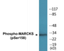 Western blot analysis of extracts from K562 cells treated with EGF 200ng/ml 30', using MARCKS (Phospho-Ser158) Antibody.