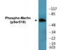 Western blot analysis of extracts from HuvEc cells treated with IFN-alpha 1000U/ml 18h, using Merlin (Phospho-Ser518) Antibody.