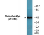 Western blot analysis of extracts from ovary cancer, using Myc (Phospho-Thr58) Antibody.