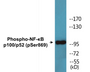 Western blot analysis of extracts from MDA-MB-435 cells treated with TNF-alpha, using NF-kappaB p100/p52 (Phospho-Ser869) Antibody.