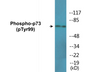 Western blot analysis of extracts from K562 cells treated with Pervanadate, using p73 (Phospho-Tyr99) Antibody.