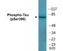 Western blot analysis of extracts from HeLa cells, using Tau (Phospho-Ser396) Antibody.