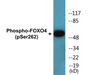 Western blot analysis of extracts from Jurkat cells treated with starved 24h, using FOXO4 (Phospho-Ser262) Antibody.