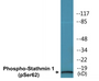 Western blot analysis of extracts from COS7 cells treated with nocodazole 1ug/ml 16h, using STMN1 (Phospho-Ser62) Antibody.