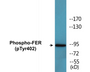 Western blot analysis of extracts from Jurkat cells treated with starved 24h, using FER (Phospho-Tyr402) Antibody.