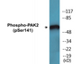Western blot analysis of extracts from HepG2 cells treated with Adriamycin 0.5uM 24h/Jurkat cells treated with PMA 125ng/ml 30', using PAK2 (Phospho-Ser141) Antibody.