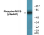 Western blot analysis of extracts from HeLa cells treated with heat shock, using PKCB (Phospho-Ser661) Antibody.