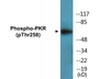 Western blot analysis of extracts from Jurkat cells treated with starved 24h, using PKR (Phospho-Thr258) Antibody.
