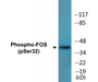 Western blot analysis of extracts from Jurkat cells treated with starved 24h, using FOS (Phospho-Ser32) Antibody.