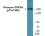 Western blot analysis of extracts from HepG2 cells treated with Ca2+ 40nM 30', using TOP2A (Phospho-Thr1343) Antibody.