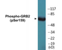 Western blot analysis of extracts from HT29 cells treated with serum 20% 15', using GRB2 (Phospho-Ser159) Antibody.