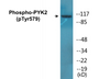 Western blot analysis of extracts from NIH-3T3 cells, using PYK2 (Phospho-Tyr579) Antibody.