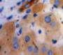 Used in DAB staining on fromalin fixed paraffin-embedded Liver tissue