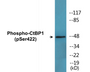 Western blot analysis of extracts from Jurkat cells treated with TNF 20ng/ml 30' and Jurkat cells treated with UV 15', using CtBP1 (Phospho-Ser422) Antibody.