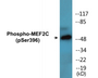 Western blot analysis of extracts from NIH-3T3 cells treated with starved 24h, using MEF2C (Phospho-Ser396) Antibody.