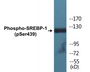 Western blot analysis of extracts from Jurkat cells treated with TNF 20ng/ml 30', using SREBP-1 (Phospho-Ser439) Antibody.