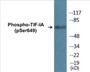 Western blot analysis of extracts from Jurkat cells treated with starved 24h, using TIF-IA (Phospho-Ser649) Antibody.