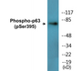 Western blot analysis of extracts from LOVO cells treated with nocodazole 1ug/ml 18h, A549 cells treated with nocodazole 1ug/ml 18h and HepG2 cells treated with nocodazole 1ug/ml 18h, using p63 (Phospho-Ser395) Antibody.