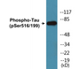 Western blot analysis of extracts from mouse brain, using MAPT (Phospho-Ser516) Antibody.