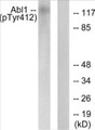 Western blot analysis of lysates from COS7 cells treated with Adriamycin 0.5ug/ml 24h, using Abl (Phospho-Tyr412) Antibody. The lane on the right is blocked with the phospho peptide.