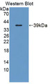 Western Blot; Sample: Recombinant protein.