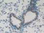 DAB staining on IHC-P; Samples: Mouse Lung Tissue;  Primary Ab: 10µg/ml Rabbit Anti-Mouse FOLR4 Anti