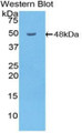 Western Blot; Sample: Recombinant protein.