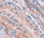 Hyaluronoglucosaminidase 1 (Hyal1) Polyclonal Antibody, Cat#CAU21070