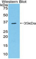 Western Blot; Sample: Recombinant protein.