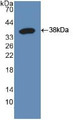 Western Blot; Sample: Recombinant Raftlin, Human.