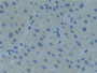 DAB staining on IHC-P; Samples: Human Liver Tissue; Primary Ab: 10µg/ml Rabbit Anti-Human Raftlin Antibody Second Ab: 2µg/mL HRP-Linked Caprine Anti-Rabbit IgG Polyclonal Antibody
