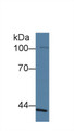 Western Blot; Sample: Human Lung lysate; ;Primary Ab: 1µg/ml Rabbit Anti-Human SLFN5 Antibody;Second Ab: 0.2µg/mL HRP-Linked Caprine Anti-Rabbit IgG Polyclonal Antibody;