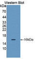 Western Blot; Sample: Recombinant protein.