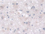 DAB staining on fromalin fixed paraffin- embedded liver tissue)