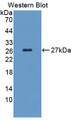 Western Blot; Sample: Recombinant protein.