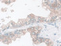 DAB staining on fromalin fixed paraffin- embedded Kidney tissue)