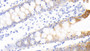 DAB staining on IHC-P; Samples: Human Colon Tissue;  Primary Ab: 20μg/ml Rabbit Anti-Human FAM5C Antibody Second Ab: 2µg/mL HRP-Linked Caprine Anti-Rabbit IgG Polyclonal Antibody 