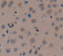 Used in DAB staining on fromalin fixed paraffin- embedded Kidney tissue