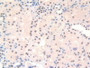 DAB staining on IHC-P; Samples: Human Kidney Tissue.