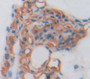 Peptidase Inhibitor 16 (Pi16) Polyclonal Antibody, Cat#CAU21109