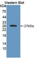 Western Blot; Sample: Recombinant protein.