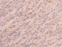 DAB staining on IHC-P; Samples: Human Spleen Tissue; Primary Ab: 20µg/ml Rabbit Anti-Human PABPC1L Antibody Second Ab: 2µg/mL HRP-Linked Caprine Anti-Rabbit IgG Polyclonal Antibody