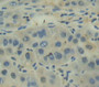 Poly A Binding Protein Cytoplasmic 1 Like Protein (Pabpc1L) Polyclonal Antibody, Cat#CAU21128