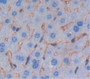 Semaphorin 4B (Sema4B) Polyclonal Antibody, Cat#CAU21136